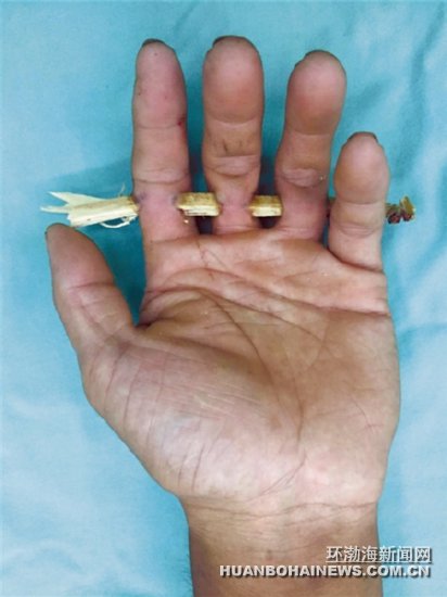 һ����3����ָ��ľ�����ɡ��Ǻ�«��